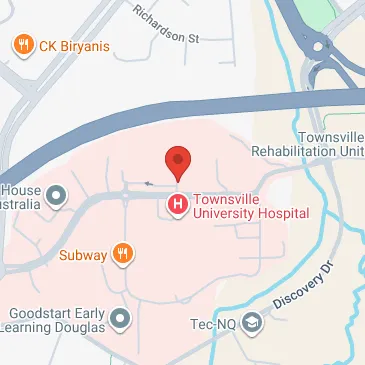 Douglas QLD parking made easy find a space near you now